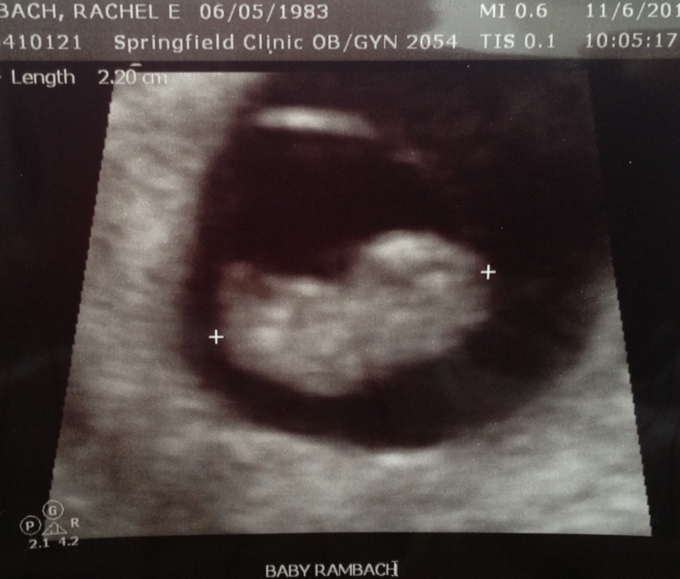Baby Rambach at 8 Weeks