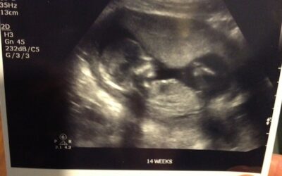 14 Weeks